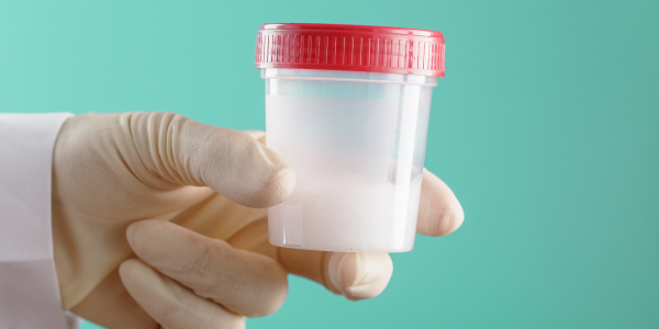CURIOSIDADES DEL SEMEN 