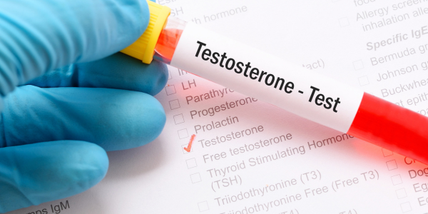 ¿Qué Pasa Si Baja la Testosterona?